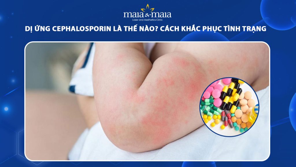 dị ứng Cephalosporin