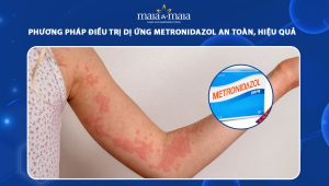 dị ứng Metronidazol