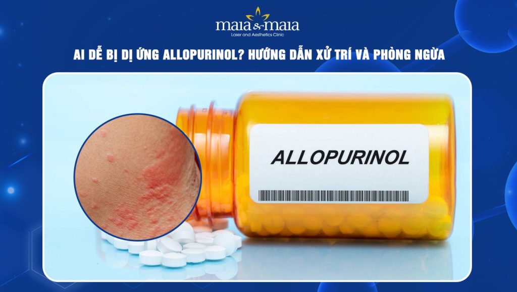 dị ứng Allopurinol