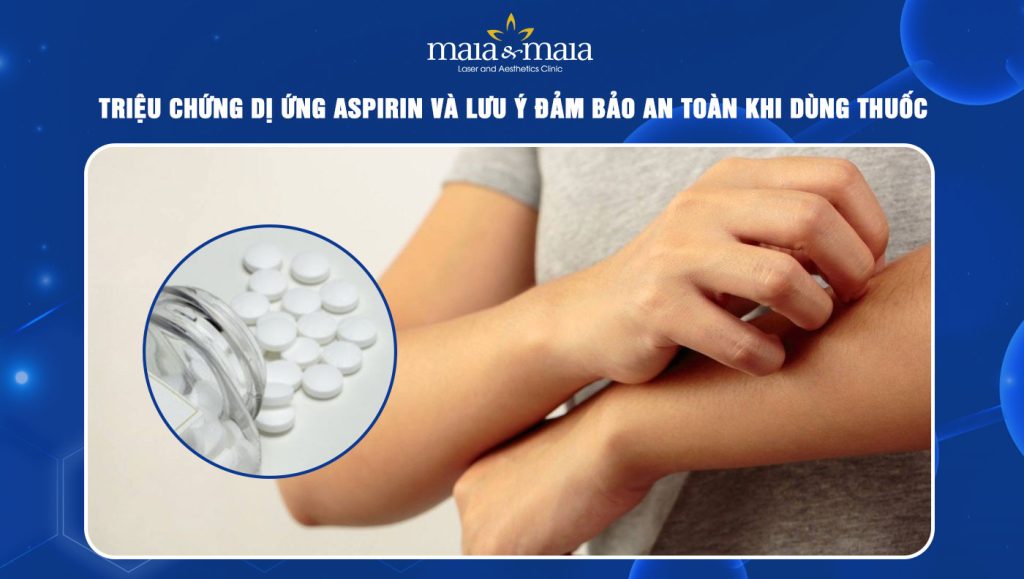 dị ứng aspirin