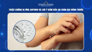 dị ứng aspirin