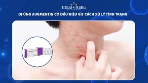 dị ứng augmentin