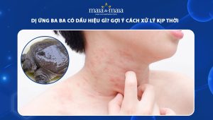 dị ứng ba ba