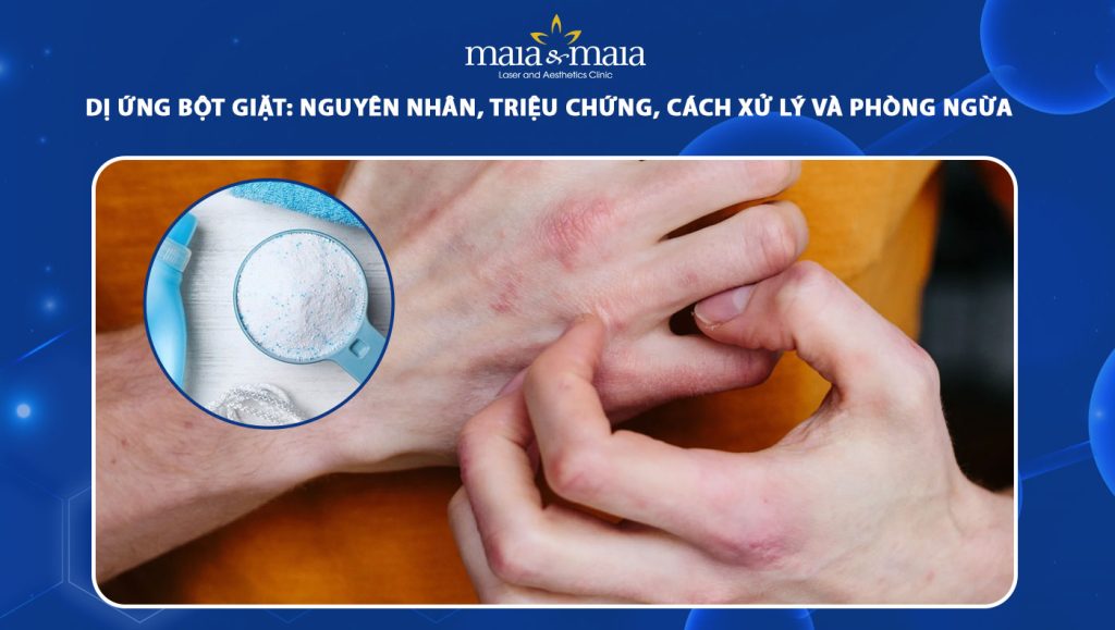 dị ứng bột giặt