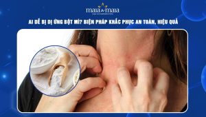 Dị ứng bột mì