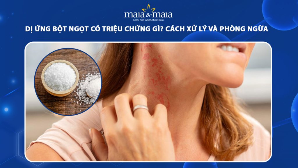 dị ứng bột ngọt