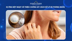 dị ứng bột ngọt