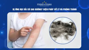 Dị ứng bụi vải