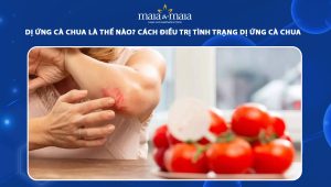 dị ứng cà chua
