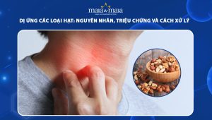 dị ứng các loại hạt