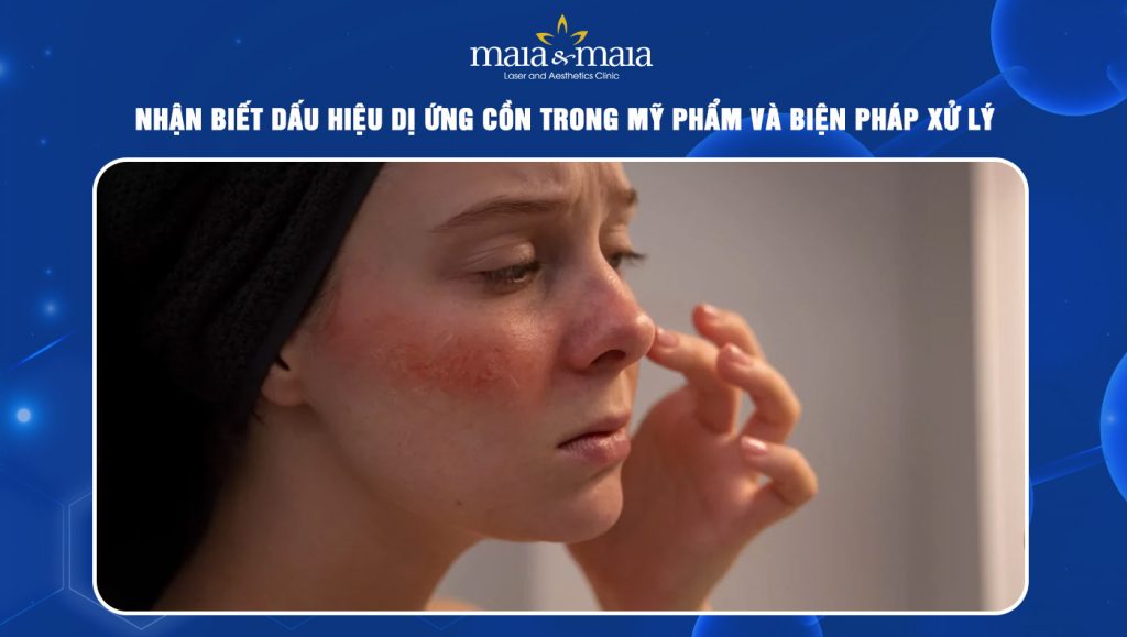 dị ứng cồn trong mỹ phẩm