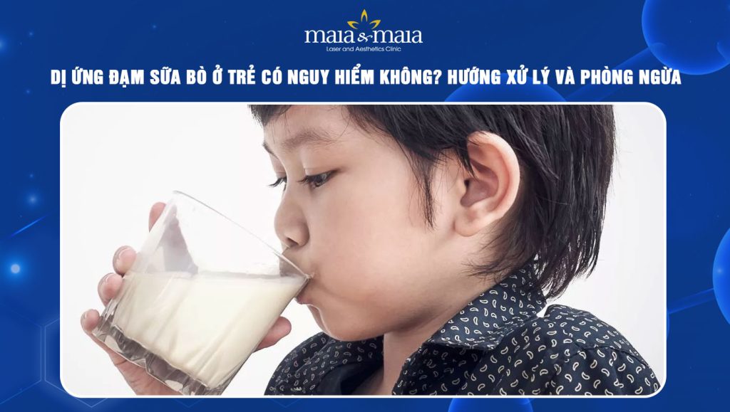 Dị ứng đạm sữa bò ở trẻ