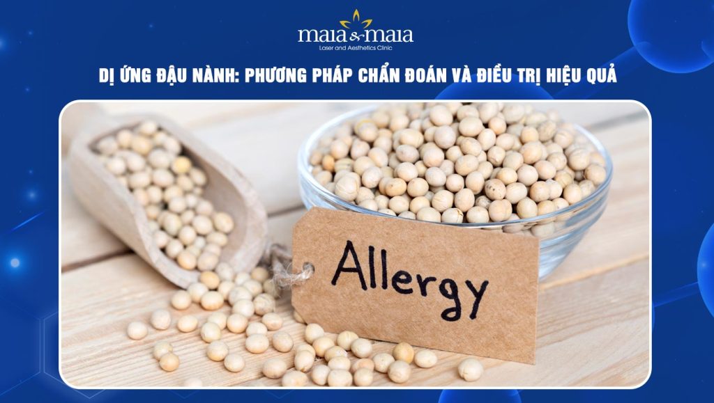 dị ứng đậu nành
