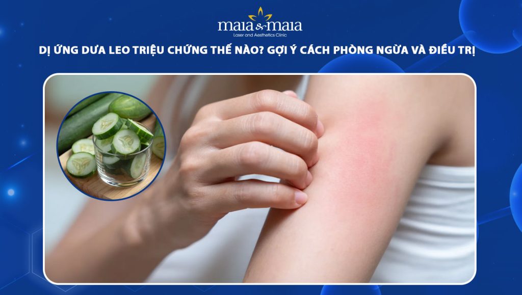 dị ứng dưa leo