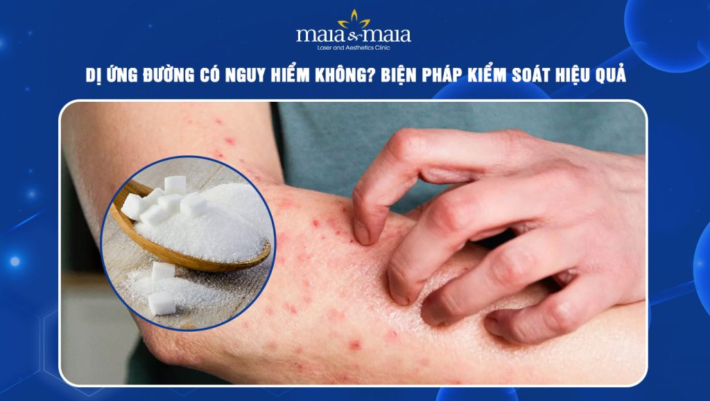 Dị ứng đường