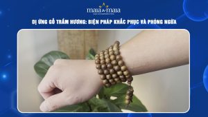 dị ứng gỗ trầm hương