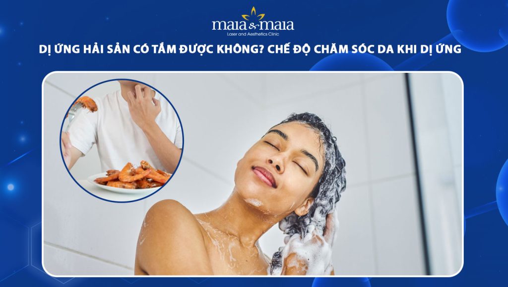 dị ứng hải sản có tắm được không