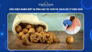 dị ứng hạt óc chó