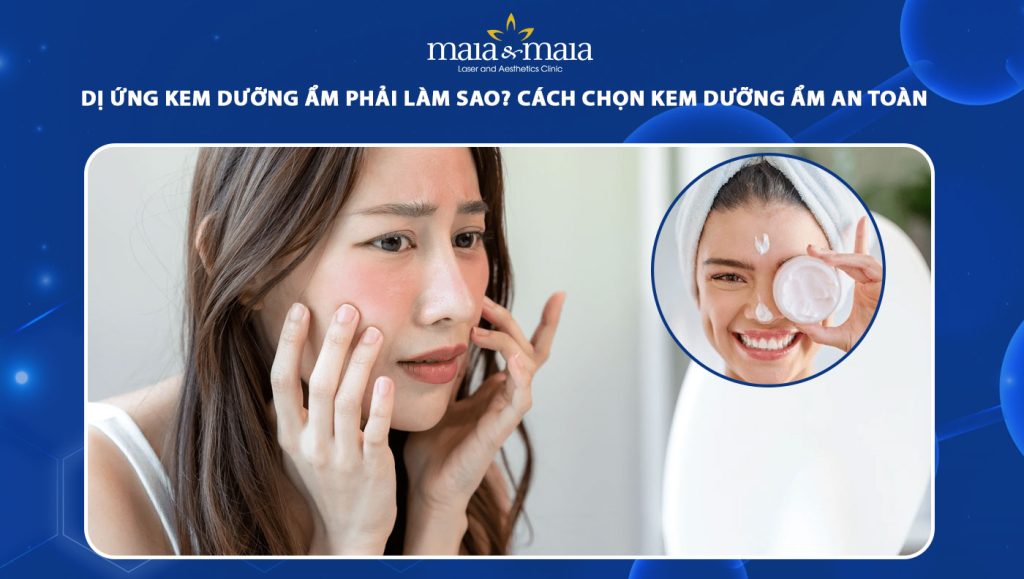dị ứng kem dưỡng ẩm