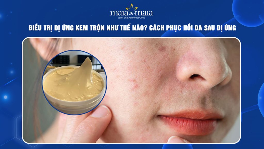 dị ứng kem trộn