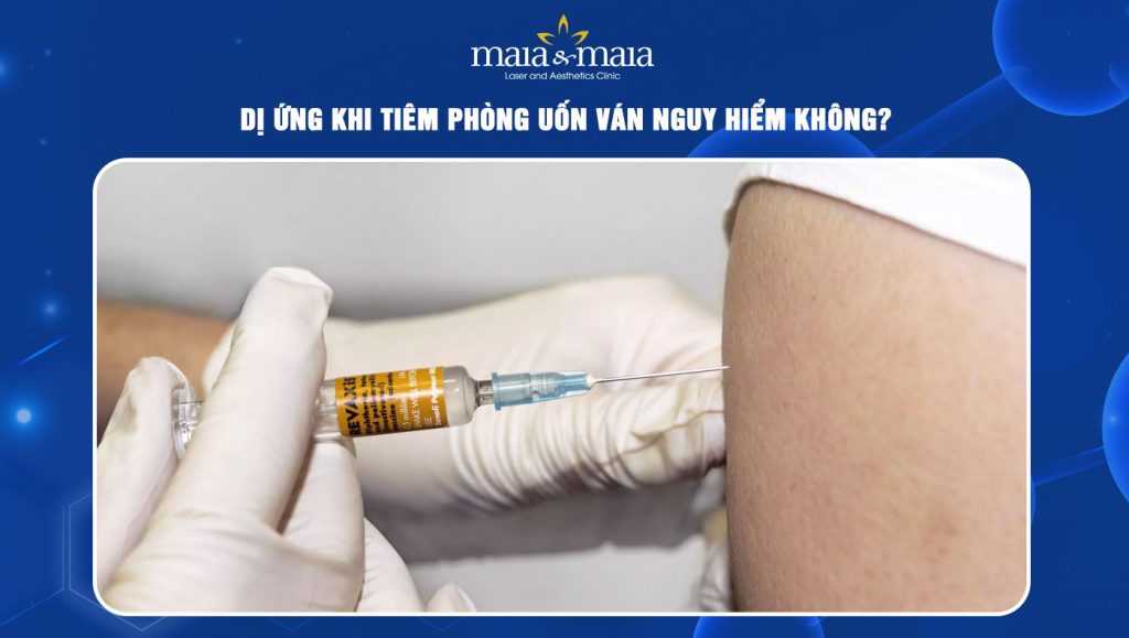 dị ứng khi tiêm phòng uốn ván