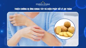 dị ứng khoai tây