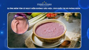 dị ứng mắm tôm