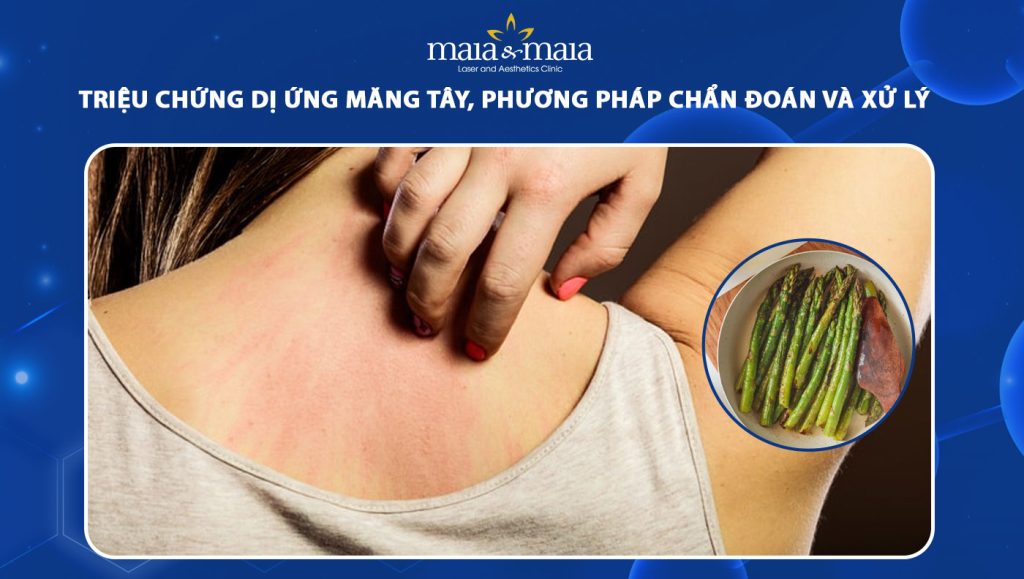 dị ứng măng tây