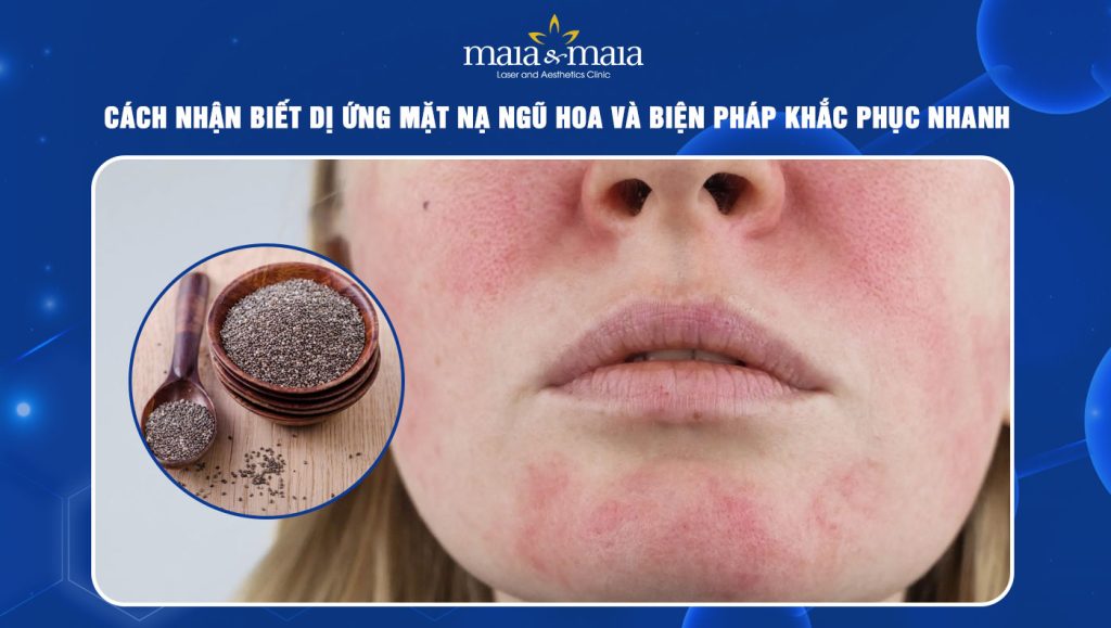 dị ứng mặt nạ ngũ hoa