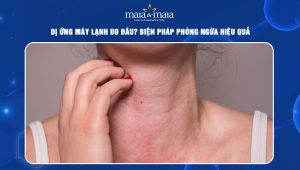 dị ứng máy lạnh