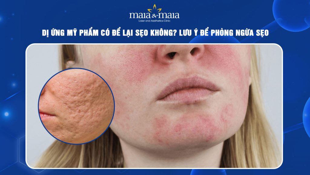 Dị ứng mỹ phẩm có để lại sẹo không