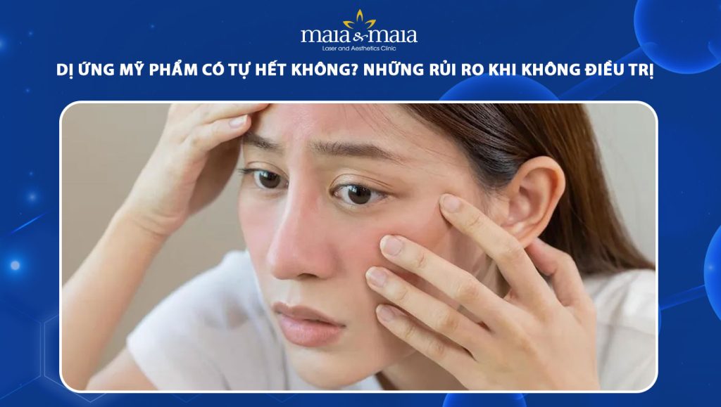 Dị ứng mỹ phẩm có tự hết không? Rủi ro nếu không điều trị sớm 1 dị ứng mỹ phẩm có tự hết không