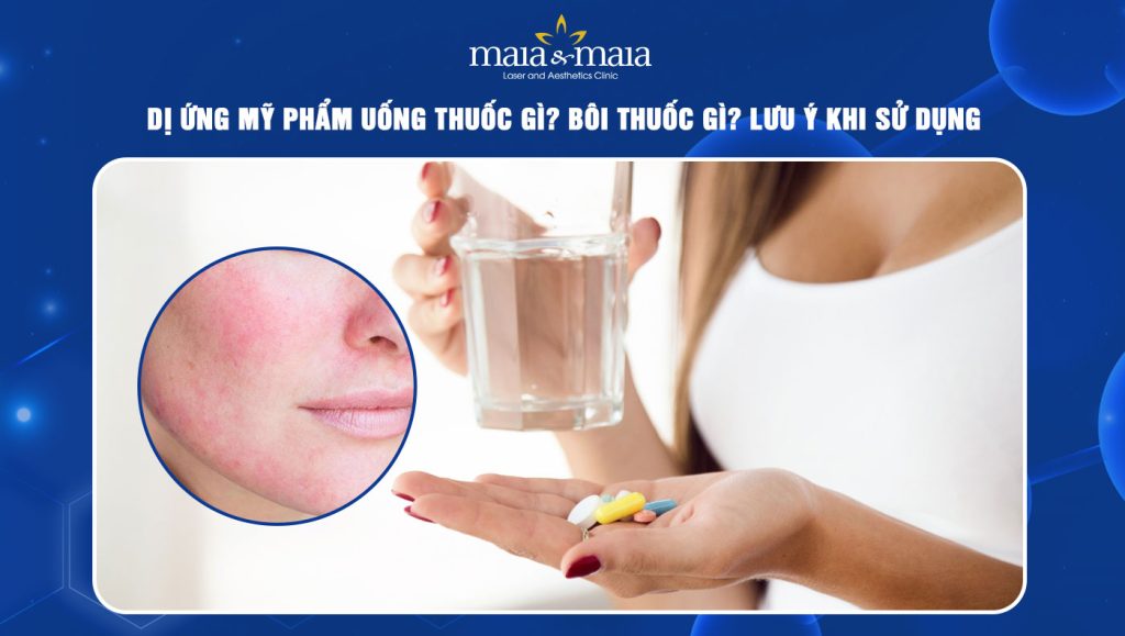 Dị ứng mỹ phẩm uống thuốc gì