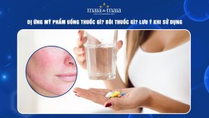 Dị ứng mỹ phẩm uống thuốc gì
