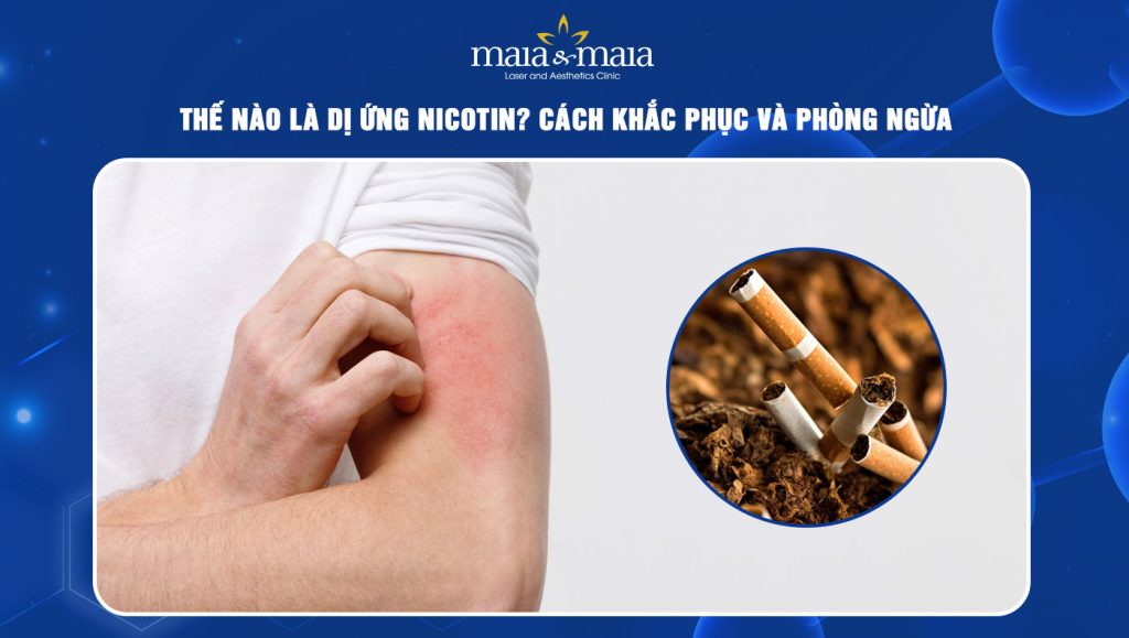 dị ứng nicotin