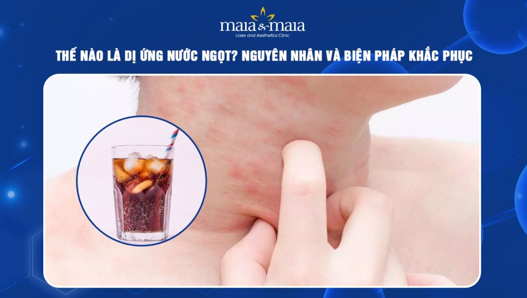 dị ứng nước ngọt