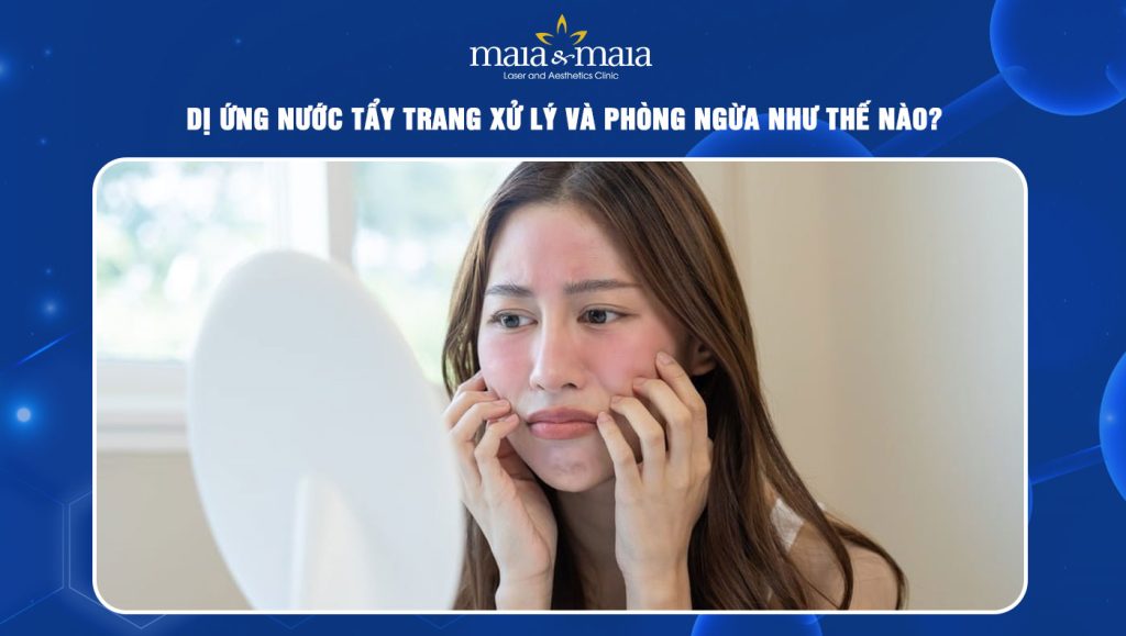 Dị ứng nước tẩy trang xử lý và phòng ngừa như thế nào? 1 Dị ứng nước tẩy trang
