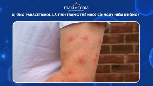 dị ứng paracetamol