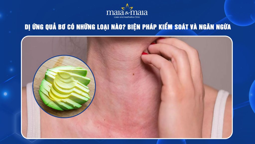 Dị ứng quả bơ