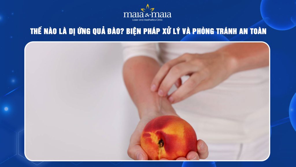 dị ứng quả đào