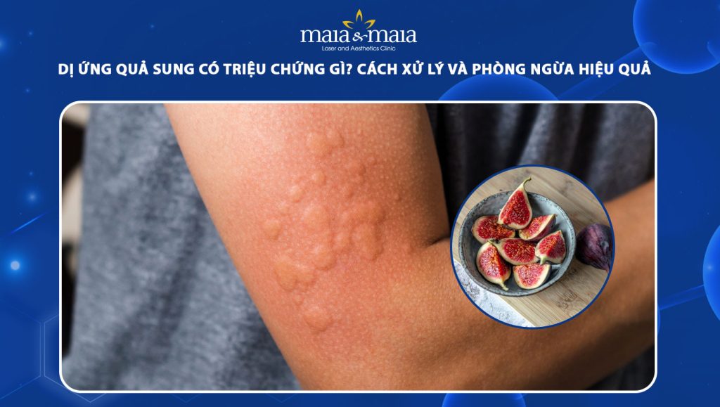 dị ứng quả sung
