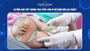 dị ứng que cấy tránh thai