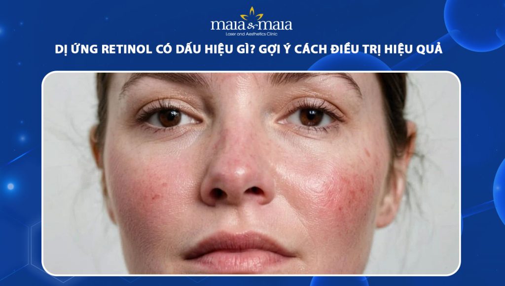 dị ứng retinol