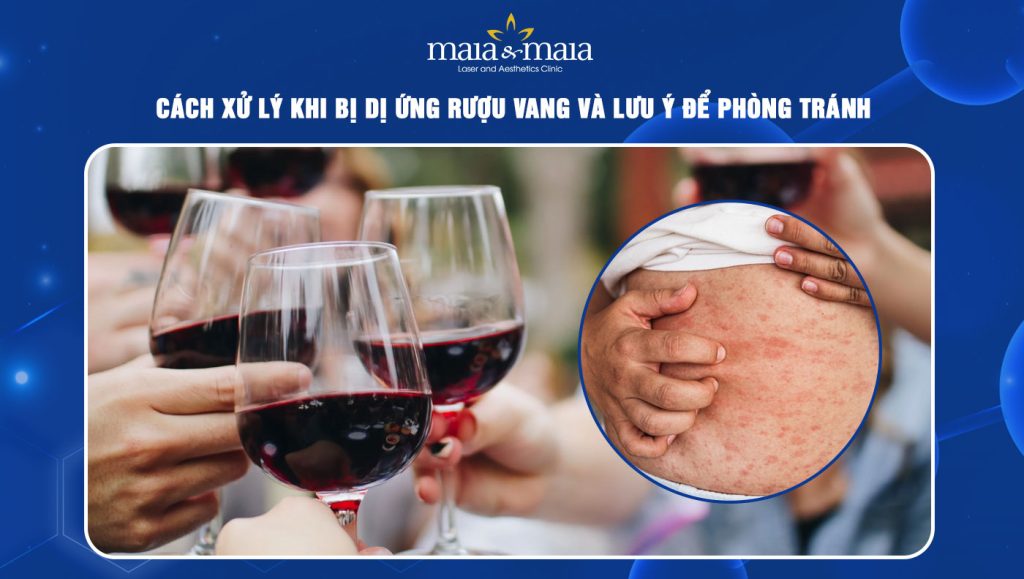 dị ứng rượu vang