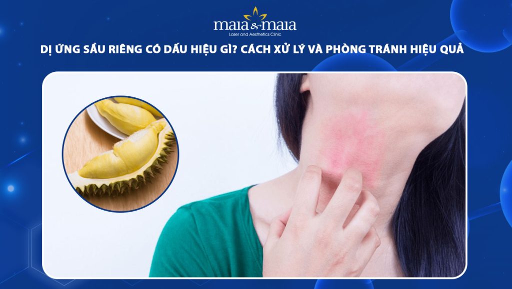 dị ứng sầu riêng