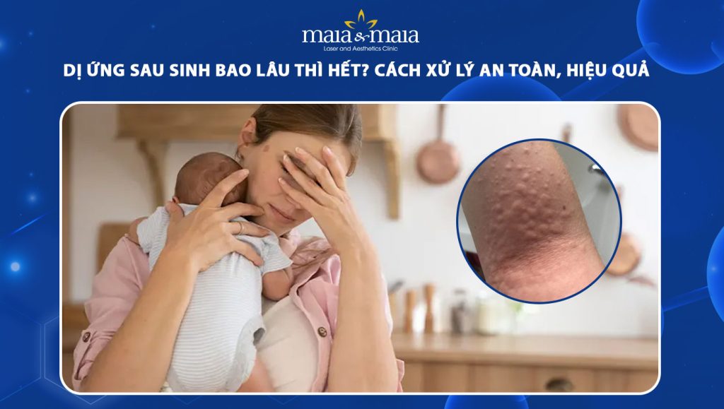 dị ứng sau sinh
