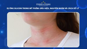 dị ứng silicon trong mỹ phẩm