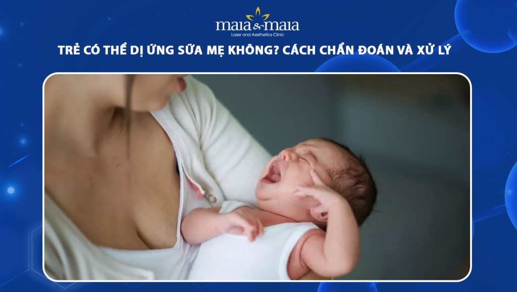 dị ứng sữa mẹ