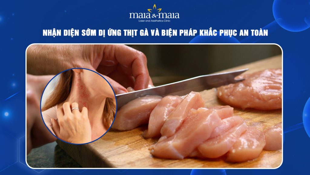 dị ứng thịt gà