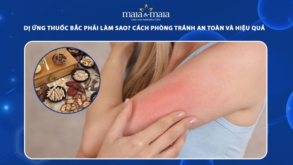 dị ứng thuốc bắc